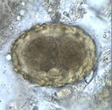 A. lumbricoides egg:: Image Courtesy Division of Parasitic Diseases/Centers for Disease Control and Prevention
